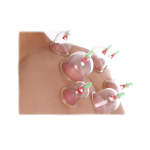 Acupuncture Cupping Set