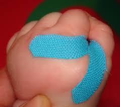 Kinesio Taping® in Paediatrics